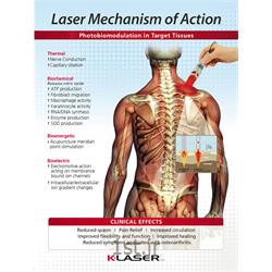 کاهش دردهای سیاتیکی با لیزر تراپی (laser therapy)