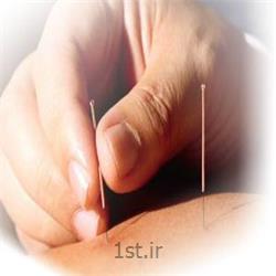 کاهش درد سریع با درمان های دستی (dry needling)