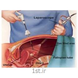 جراحی لاپاراسکوپی توسط دکتر ژیلا عابدی laparoscopy
