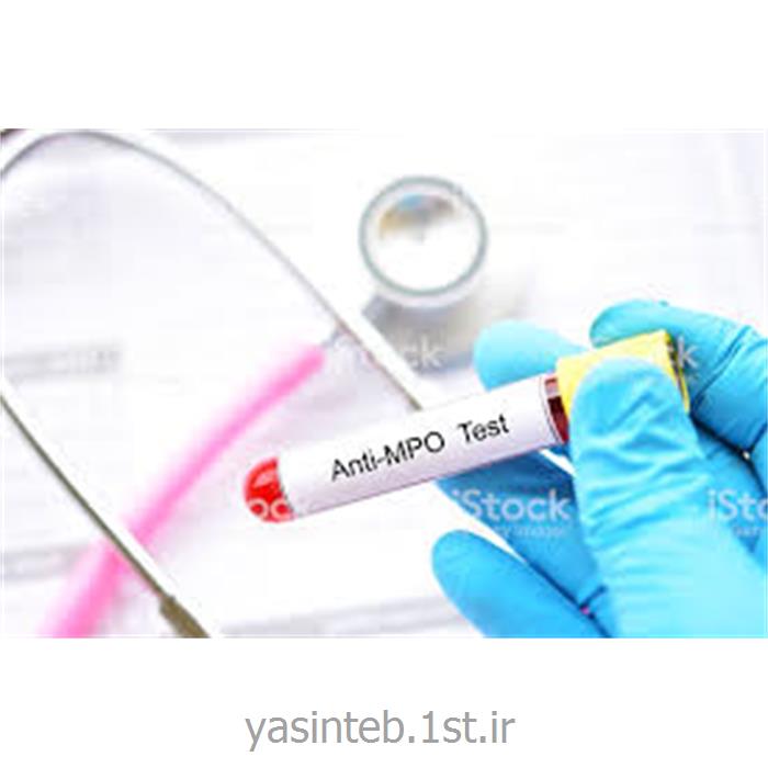 آنتی ام پی او (پی_آ ان سی آ)