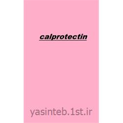 کاست کالپروتکتین 1 تست جنریک اسیز