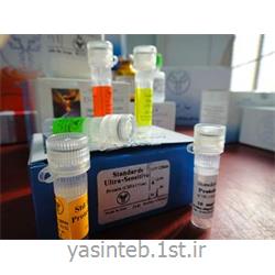 TLCاسیدهای آمینه (آنالیز اسیدهای آمینه به روش TLC)