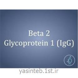 ترومبوزیس B2-گلیکوپروتیین IgM