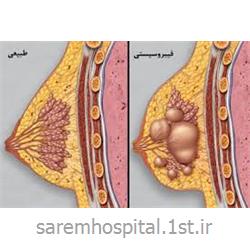 عکس جراحیجراحی تخصصی سرطان پستان