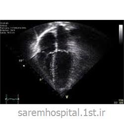 عکس تشخیص و درمان درداکوکاردیوگرافی (اکوی قلبی) قلب و عروق