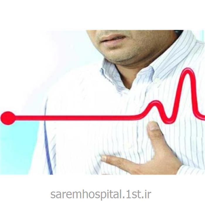 الکتروکاردیوگرافی سکته قلبی ( نوار قلب ECG) از بیمارستان صارم
