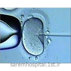 عکس تشخیص و درمان دردلقاح مصنوعی میکرواینجکشن (IVF)