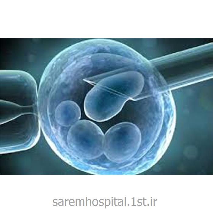 جنین آزمایشگاهی با سلولهای بالغ تخمک و اسپرم به روش ART