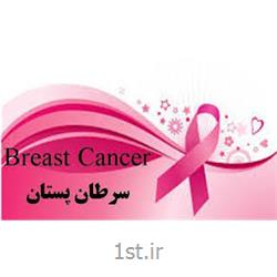 غربالگری سرطان پستان (ماموگرافی)