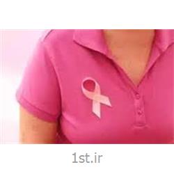 غربالگری سرطان پستان (ماموگرافی)