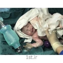 عکس جراحیجراحی سزارین نوزادان در بیمارستان فرمانیه