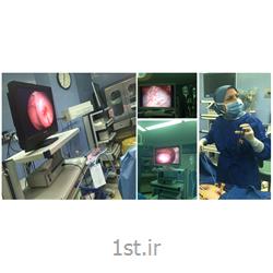 عکس جراحیکولپوسکوپی مشاهده اپی تلیوم سرویکس