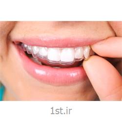 ارتودنسی متحرک اینویزالاین با پلاک های شفاف / دندانپزشکی مروارید