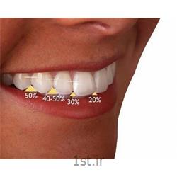 اصلاح طرح لبخند دندان و زیبایی خنده / دندانپزشکی مروارید