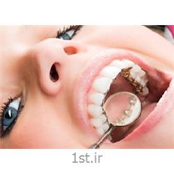 ارتودنسی نامرئی لینگوال یا زبانی ( پنهان از داخل و پشت دندان )