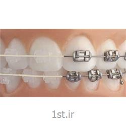 ارتودنسی ثابت با براکت سرامیکی و شیشه ای همرنگ دندان