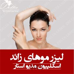 مرکز لیزر موهای زائد در غرب تهران
