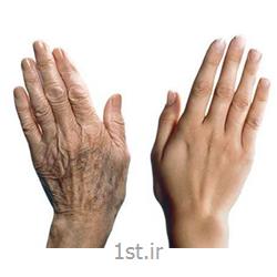 جوانسازی پوست روی دست با لیزر فوتونا