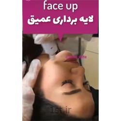 فیساپ صورت ( درمان لک )